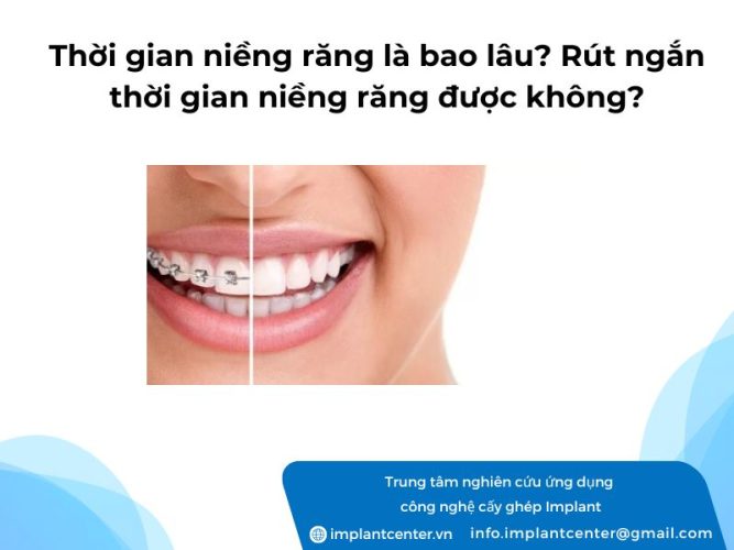 thoi-gian-nieng-rang